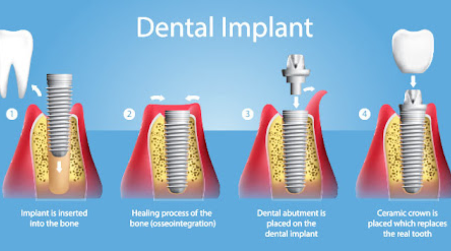 Dental Surgery Clinic in South Mumbai